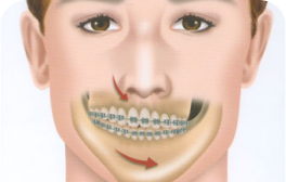 Desalinhamento facial ou rosto inclinado (Assimetria facial)